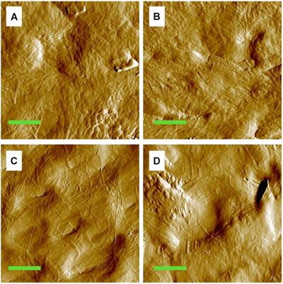 Disuse Impairs the Mechanical Competence of Bone by Regulating the Characterizations of Mineralized Collagen Fibrils in Cortical Bone